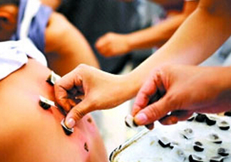 三伏灸什么時候做最好？?三伏灸可以晚上做嗎？