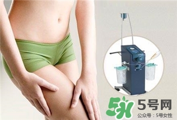 水動力吸脂是什么?水動力吸脂怎么樣? 水動力吸脂是什么?水動力吸脂怎么樣?