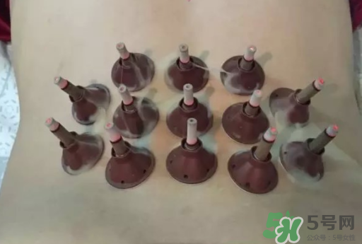 艾艾貼可以貼肚臍眼嗎？艾艾貼貼肚臍有什么作用？