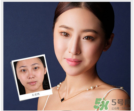 填充淚溝有風(fēng)險嗎？填充淚溝的方法