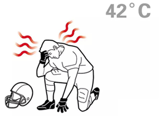 熱射病為什么不能喝水？熱射病為什么會(huì)抽搐