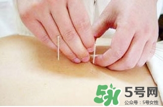 什么人不能做放血療法？放血療法有什么功效？