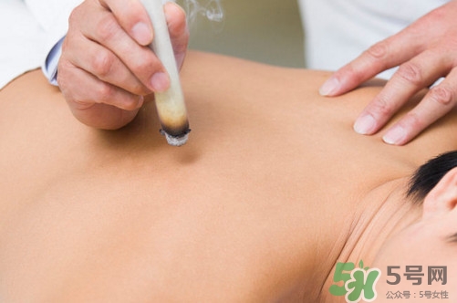 三伏灸一次做多長(zhǎng)時(shí)間？三伏灸用新生姜好還是老的好