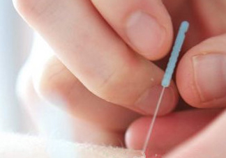 什么是放血療法？放血療法能治什么病