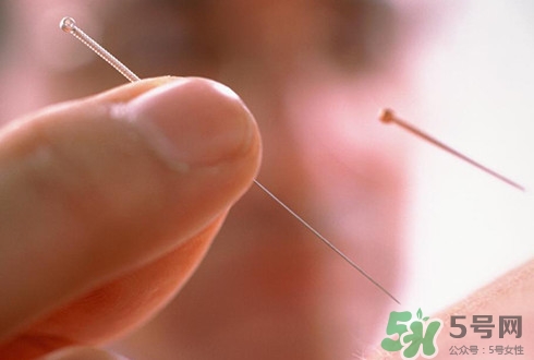 針灸可以治療失眠嗎？失眠時(shí)針灸哪些穴位有效