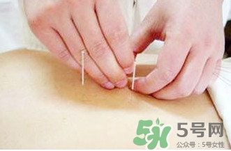針灸可以天天扎嗎？針灸可以每天扎嗎