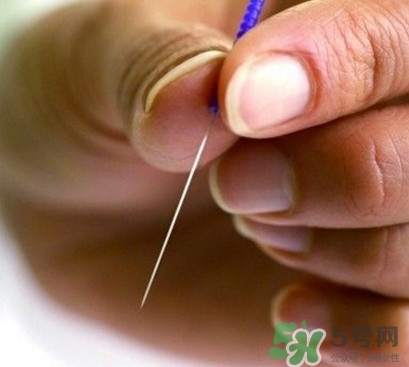 放血療法能治濕氣重嗎？放血療法治病的原理是什么