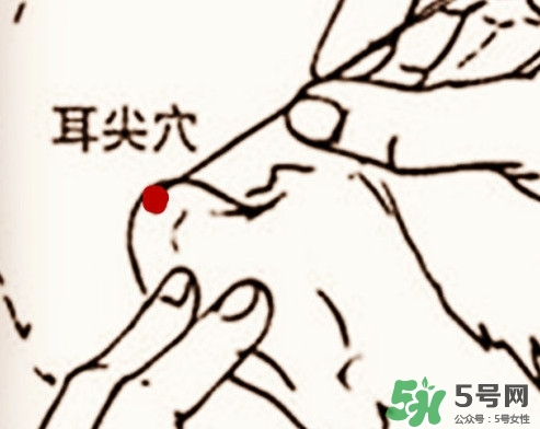 什么人不能做放血療法？放血療法有什么功效？