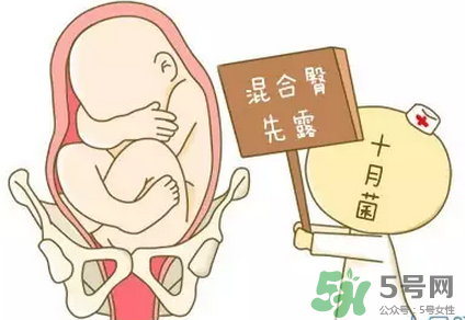 胎位不正能順產(chǎn)嗎？胎位不正怎么辦？