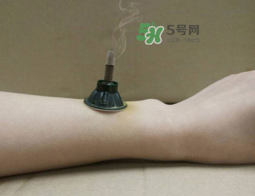 三伏天下雨可以艾灸嗎？三伏天下雨艾灸好嗎？