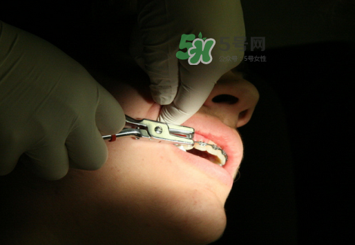 三伏天可以拔牙嗎嗎?三伏天拔牙好嗎？