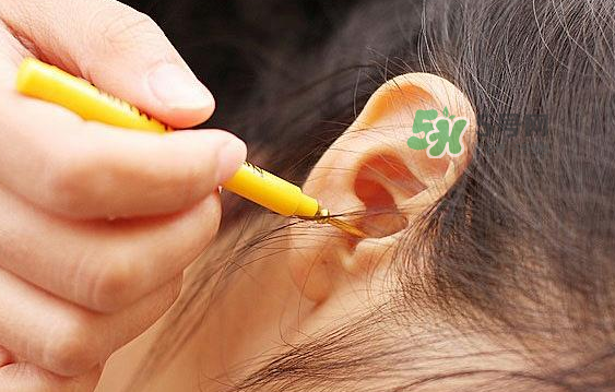 兒童耳屎成硬塊怎么辦？?jī)和撼捎矇K有危害嗎？