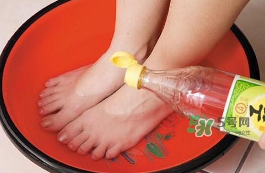 醋泡腳用白醋還是陳醋？泡腳用什么醋最好？