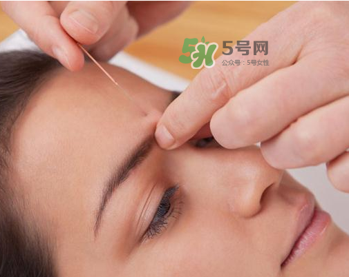 三伏天針灸有什么好處？三伏天針灸注意什么？