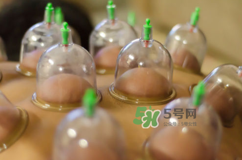 拔火罐是夏天好還是冬天好？什么時(shí)候拔火罐最合適？