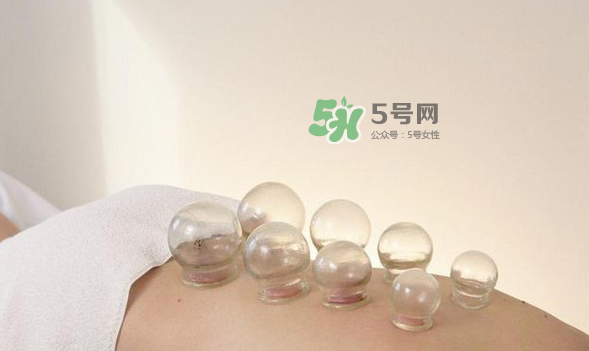 拔火罐是夏天好還是冬天好？什么時(shí)候拔火罐最合適？