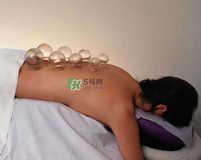 拔火罐一次多長時間？拔火罐一般多長時間？