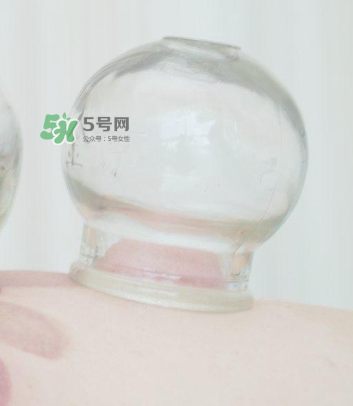 拔火罐一次多長時間？拔火罐一般多長時間？