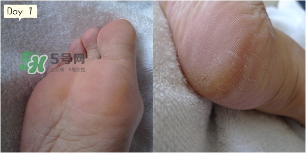 baby foot足膜怎么用？baby foot足膜使用方法