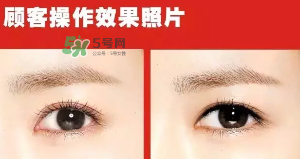 美瞳線(xiàn)有必要做嗎？做美瞳線(xiàn)多少錢(qián)？