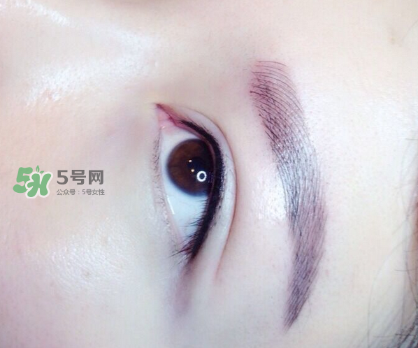 做美瞳線疼嗎？做美瞳線后要注意什么？