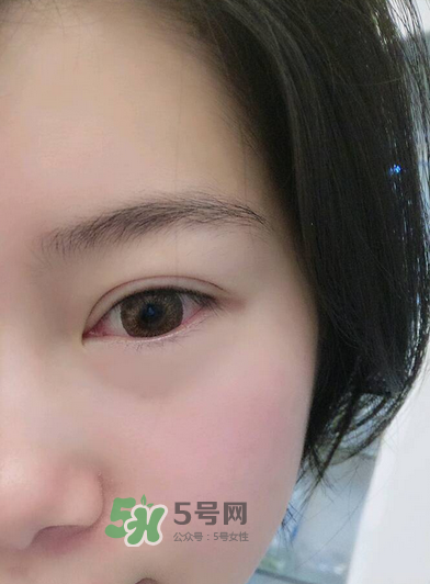 做美瞳線疼嗎？做美瞳線后要注意什么？