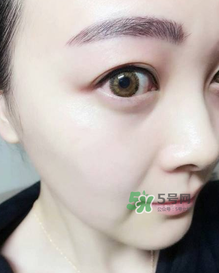 做美瞳線對眼睛有傷害嗎？做美瞳線會傷眼睛嗎？