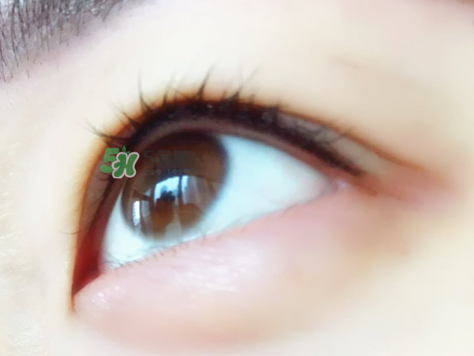 做美瞳線麻藥進眼睛怎么辦？做美瞳線麻藥灼傷眼睛怎么辦？