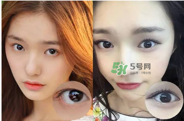 做美瞳線會不會掉睫毛？做美瞳線掉睫毛怎么辦？