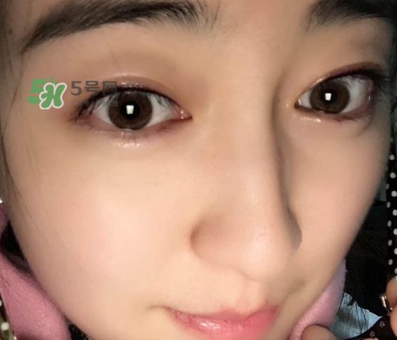 做美瞳線可以喝酒嗎？做美瞳線喝酒有影響嗎？