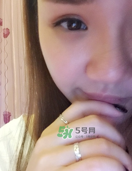 做美瞳線(xiàn)可以吃海鮮嗎？做美瞳線(xiàn)能吃海鮮嗎？