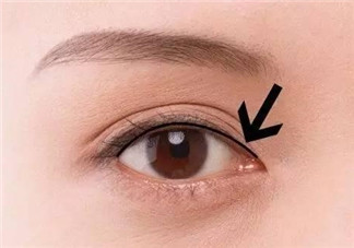 做美瞳線可以吃雞蛋嗎？做美瞳線能吃雞蛋嗎？