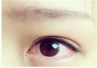 美瞳線有必要做嗎？做美瞳線多少錢？