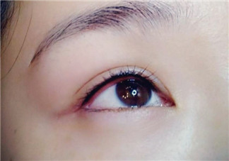 做美瞳線疼嗎？做美瞳線后要注意什么？