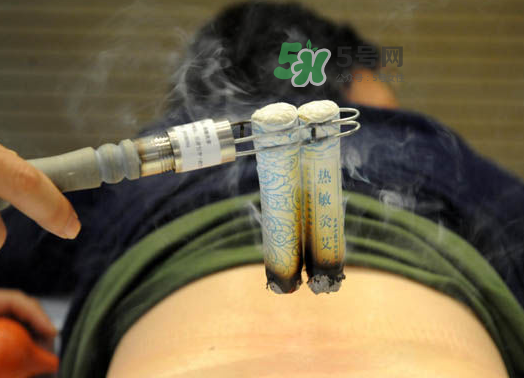 三伏天艾灸后能吹空調(diào)嗎？三伏天艾灸后能吹電扇嗎？