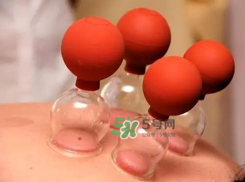 三伏天拔罐好嗎？三伏天拔罐好還是艾灸好？