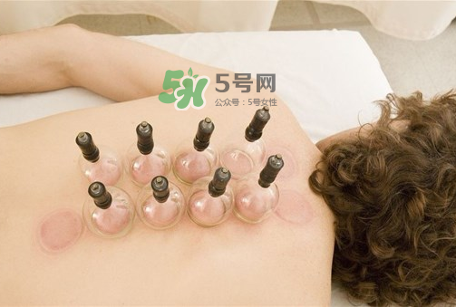 三伏天拔罐好嗎？三伏天拔罐好還是艾灸好？