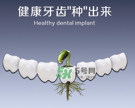 種植牙費(fèi)用多少錢(qián)？國(guó)產(chǎn)種植牙價(jià)格