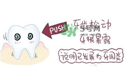 牙齒松動(dòng)會自己好嗎？牙齒松動(dòng)會自己掉嗎