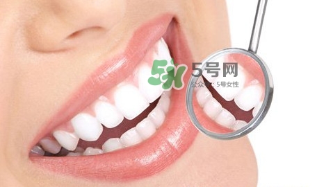 牙齒縫隙大怎么辦？牙縫大帶牙套有用嗎