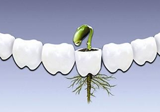 種植牙多少錢一顆？為什么種植牙很貴