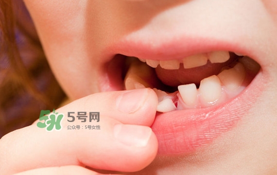 牙齒松動可以重新長牢固嗎？牙齒松動可以修復(fù)嗎