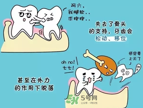 牙齒松動(dòng)會自己好嗎？牙齒松動(dòng)會自己掉嗎