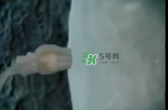 懷孕初期怎么保胎？陰道出血是流產(chǎn)征兆嗎？