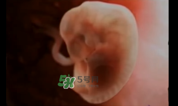 懷孕初期怎么保胎？陰道出血是流產(chǎn)征兆嗎？