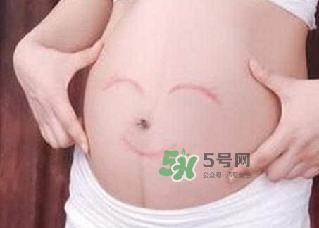 產(chǎn)婦胃脹氣怎么緩解？產(chǎn)婦胃脹氣怎么辦？