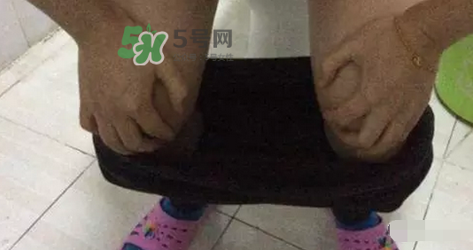 孕期可以蹲著上廁所嗎？孕期上廁所會壓到寶寶嗎？