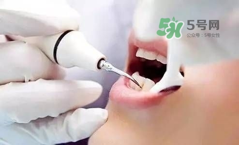 孕婦能矯正牙齒嗎？懷孕期間可以矯正牙齒嗎？