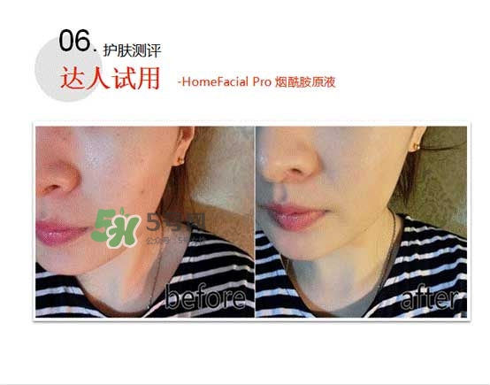 homefacialpro煙酰胺原液怎么樣？hfp煙酰胺原液好用嗎