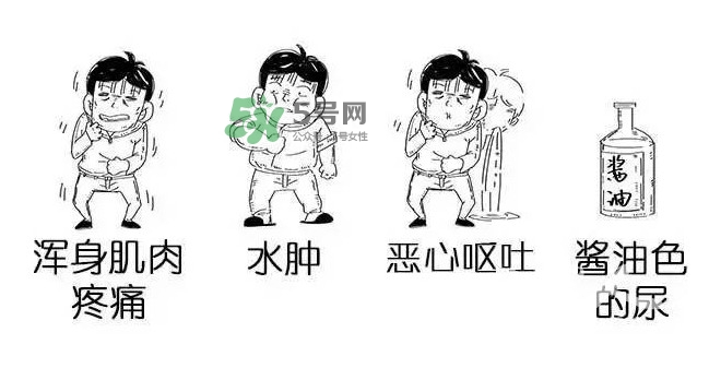 吃小龍蝦什么會(huì)得橫紋肌溶解癥？橫紋肌溶解癥嚴(yán)重嗎